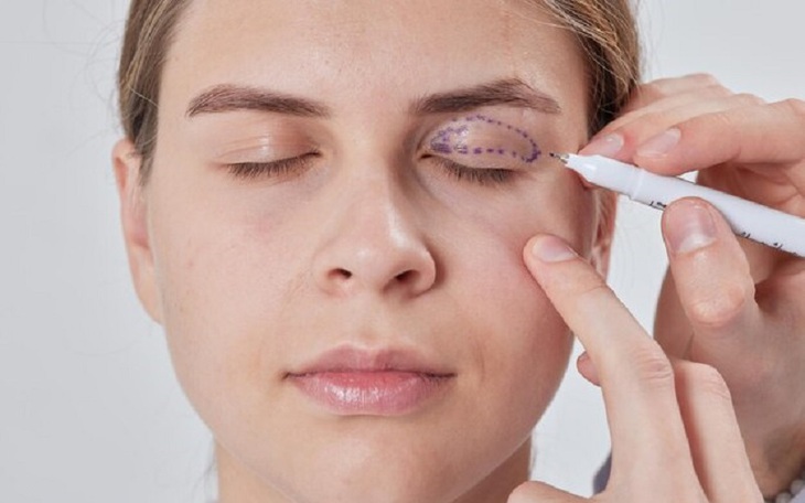Nhận biết nhược cơ và biến chứng nguy hiểm