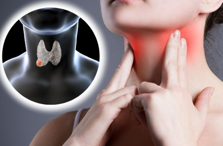 Chuyên gia chỉ cách ổn định nhân tuyến giáp: Không to lên, không biến chứng- Ảnh 2.