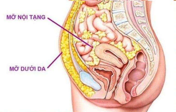 6 điều bạn nên làm để giảm mỡ nội tạng hiệu quả, bền vững- Ảnh 1.