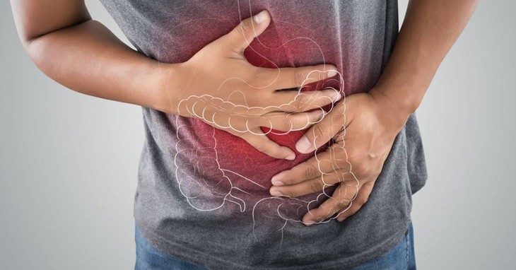 Người bị viêm loét đại trực tràng chảy máu có nguy cơ bị ung thư không?- Ảnh 1. Người bị viêm loét đại trực tràng chảy máu có nguy cơ bị ung thư không?- Ảnh 1.