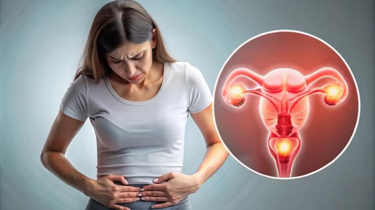 Đau bụng dưới cảnh giác với xoắn buồng trứng- Ảnh 1.