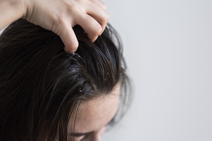 Cách chăm sóc tóc mọc nhanh, giảm gãy rụng trong mùa lạnh- Ảnh 1.