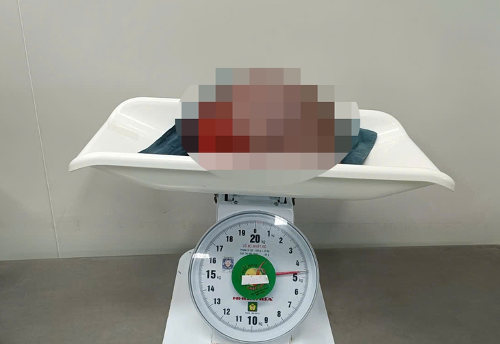 Bệnh viện tuyến tỉnh phối hợp chuyên gia nước ngoài phẫu thuật thành công bướu vú 4,5 kg- Ảnh 2.