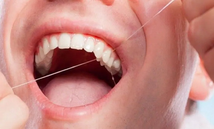 Chăm sóc tốt răng miệng giúp phòng tránh nhiều bệnh lý nguy hiểm.- Ảnh 1.