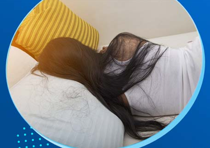 Thói quen khi ngủ gây rụng tóc và cách khắc phục- Ảnh 1.