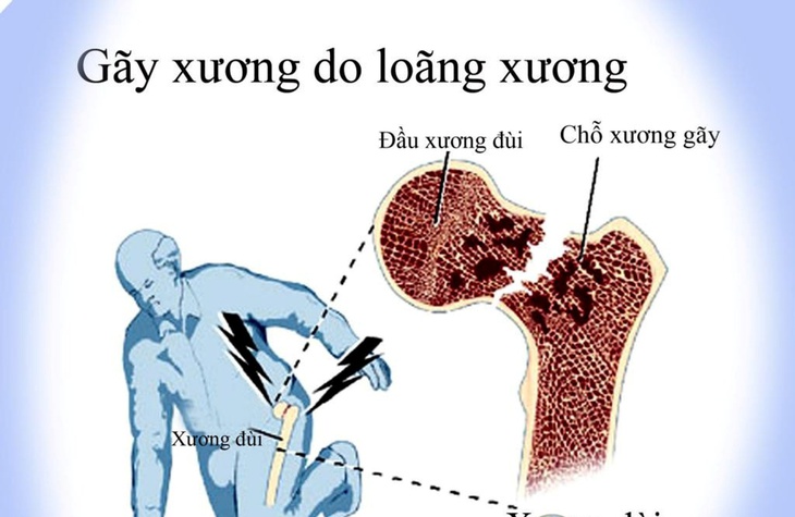 Lắng nghe sức khỏe xương khớp- Ảnh 1.