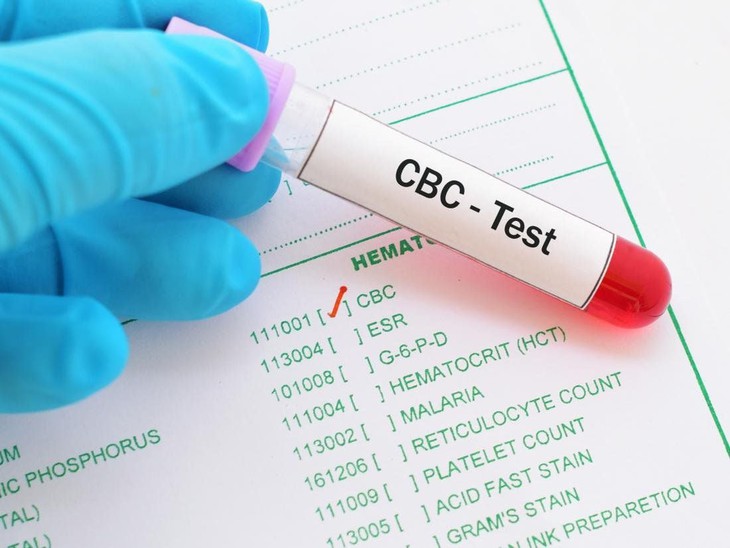 Ý nghĩa lâm sàng xét nghiệm máu toàn bộ (CBC) | Vinmec