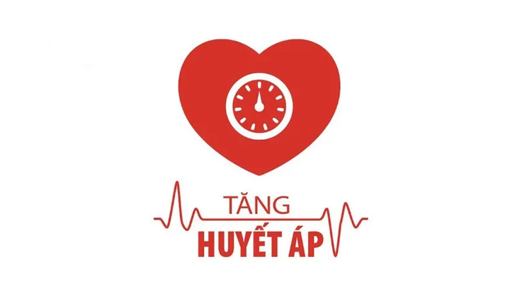 Nguyên nhân tai biến mạch máu não: Những yếu tố âm thầm cần cảnh giác- Ảnh 2.