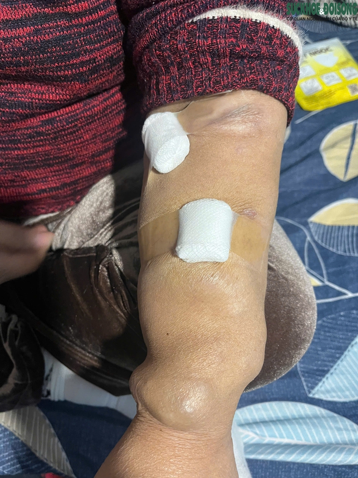 Xóm chạy thận Hà Nội co ro trong giá rét- Ảnh 5.