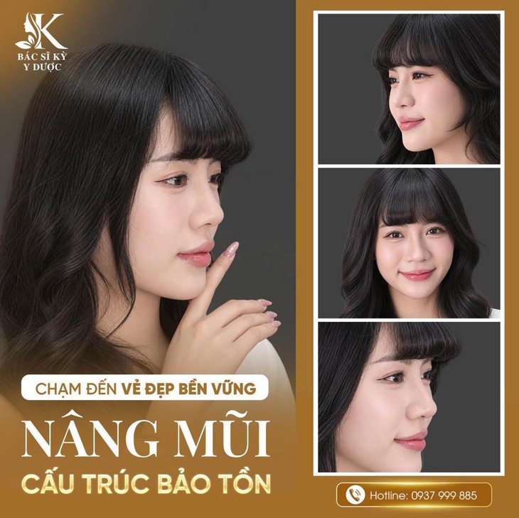 Nâng mũi cấu trúc bảo tồn là gì?- Ảnh 2.