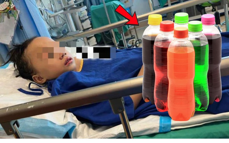 Uống nước ngọt, ăn món khoái khẩu mỗi ngày, nam sinh 14 tuổi suy thận cấp- Ảnh 2.