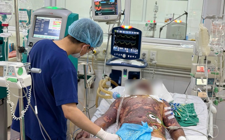 Mua thịt lợn nhiễm bệnh về chế biến lạp sườn, thịt sấy để bán ra thị trường- Ảnh 2.