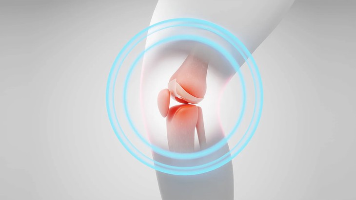 Giải pháp mới thay thế phẫu thuật giúp giảm đau do thoái hóa khớp tới 1 năm- Ảnh 1.