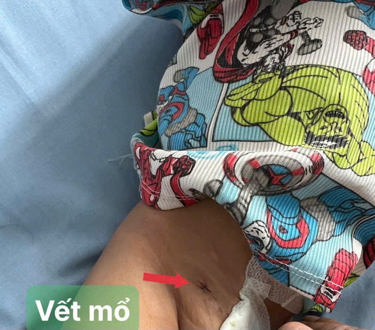 Nhiều người dân vùng nông thôn ở Khánh Hòa được điều trị bệnh khó ngay gần nhà- Ảnh 1.