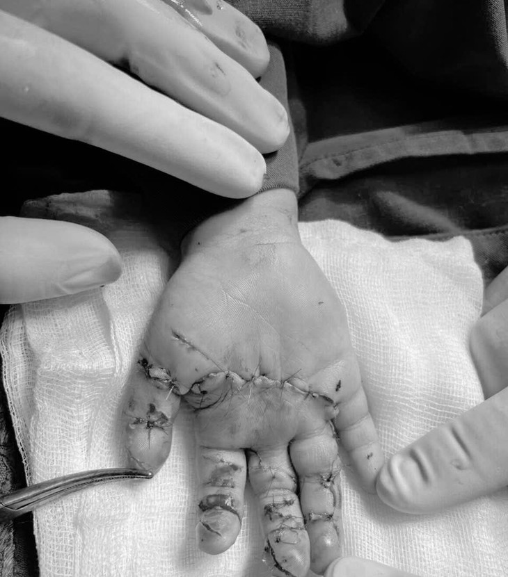 Nhiều người dân vùng nông thôn ở Khánh Hòa được điều trị bệnh khó ngay gần nhà- Ảnh 2.