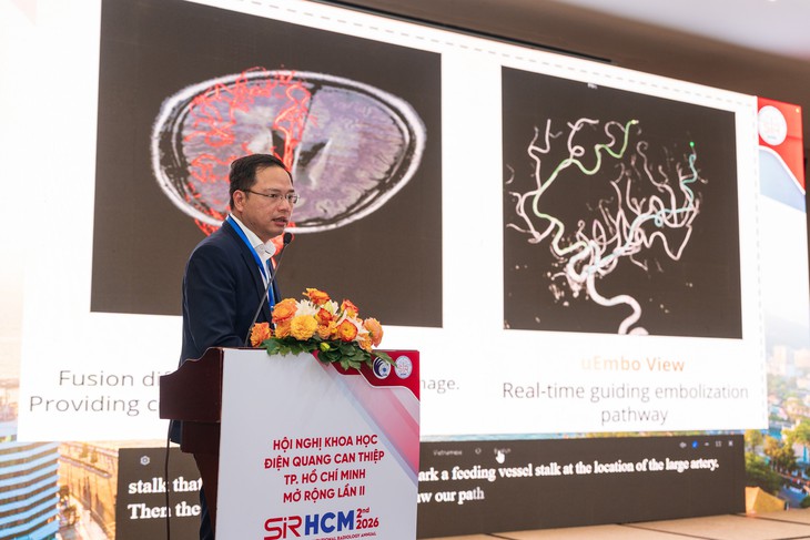 Cập nhật kỹ thuật điện quang can thiệp tiên tiến, giảm xâm lấn cho người bệnh- Ảnh 1.