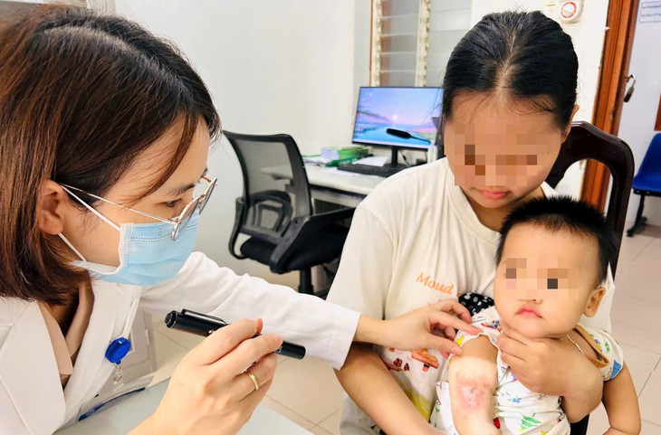 Viêm da do kiến ba khoang tăng ở Huế, cảnh báo việc tự chẩn đoán điều trị- Ảnh 1.