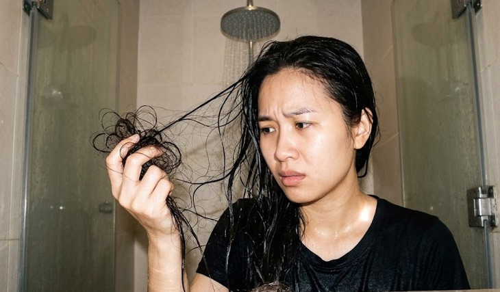 Rụng tóc bao nhiêu khi gội đầu là bình thường? 5 cách hạn chế rụng tóc - Ảnh 1.
