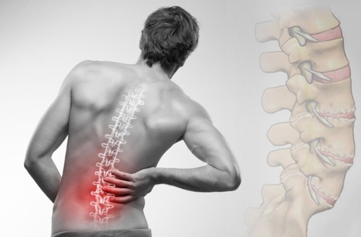 Người ngoài 60 tuổi, muốn tránh đau lưng: Hãy thay đổi một số thói quen hàng ngày - Ảnh 1.