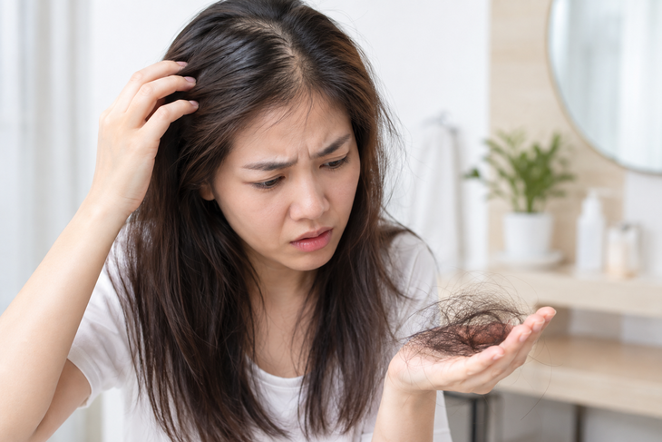8 nguyên nhân tiềm ẩn gây rụng tóc, hói đầu và cách khắc phục - Ảnh 1.