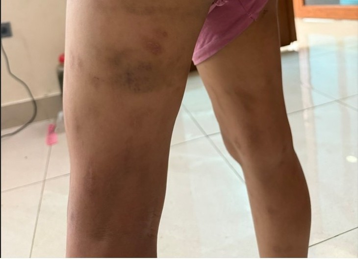 Ác mộng của 2 cháu bé liên tục bị bố đẻ hành hạ, ngược đãi - Ảnh 2.