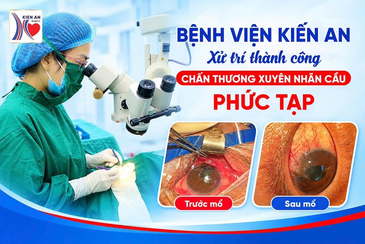 Bảo tồn thị lực cho bệnh nhân bị mảnh bát vỡ đâm xuyên nhãn cầu - Ảnh 1.