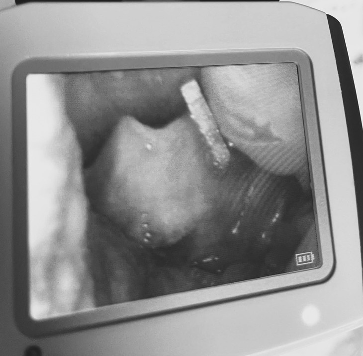 Cảnh báo nguy hiểm khi trẻ nuốt nam châm từ đồ chơi xếp hình - Ảnh 1.