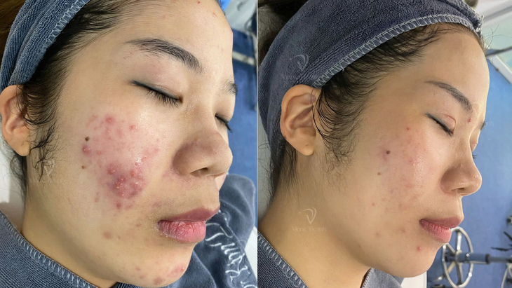 Vinnic định hướng phát triển điều trị da liễu trên nền tảng y khoa, cá nhân hóa- Ảnh 3.