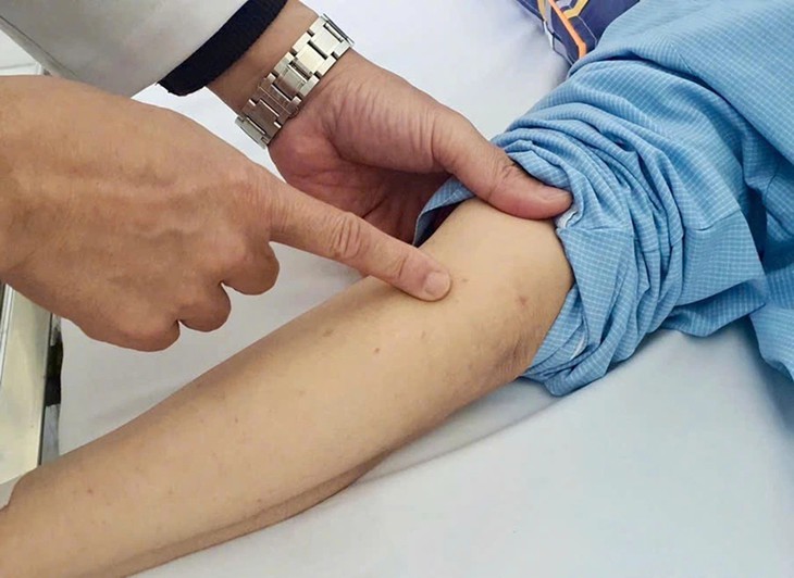 Quên loại vắc xin từng tiêm cho con: Phụ huynh bình tĩnh làm điều này- Ảnh 3.