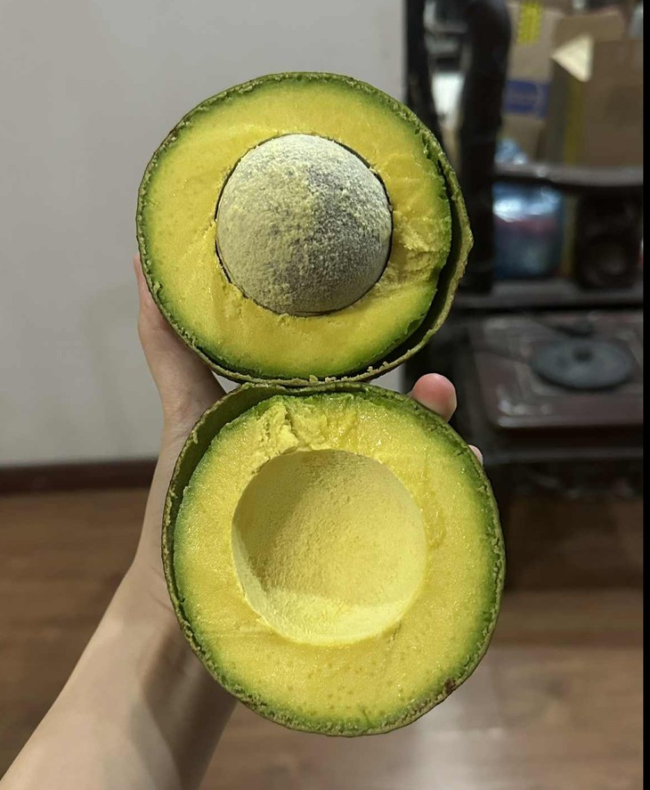 Ăn quả bơ mỗi ngày, người đàn ông mọc u vàng khắp người - Ảnh 1.
