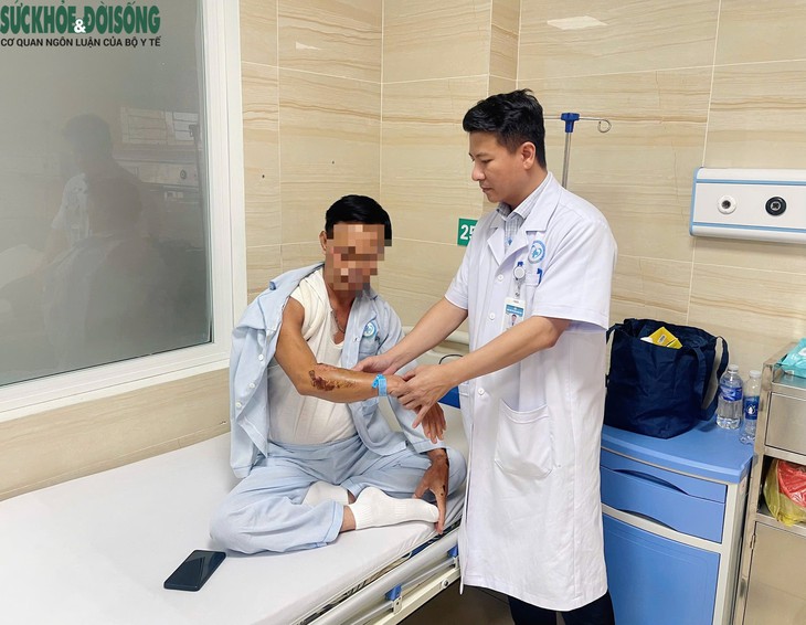Nhiều người gặp chấn thương nặng vì vật nuôi thả rông- Ảnh 3.