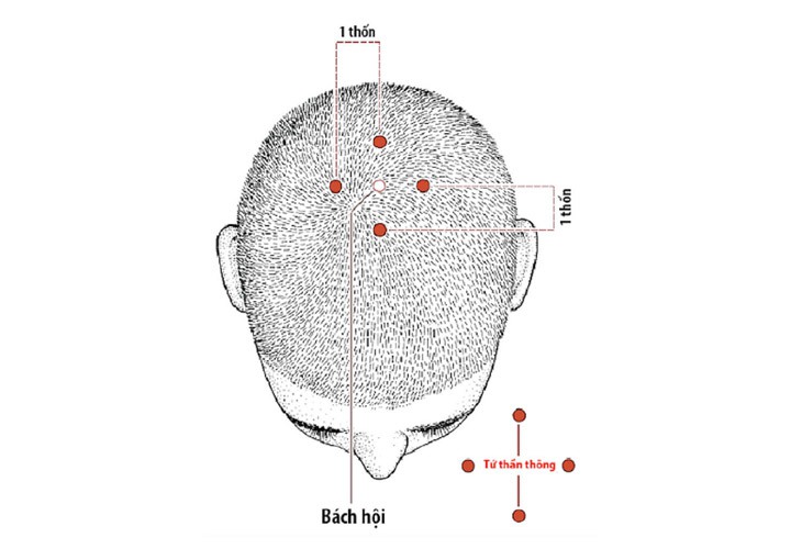 Day bấm 4 huyệt này đều đặn mỗi ngày sẽ giúp bạn ngủ ngon- Ảnh 2.