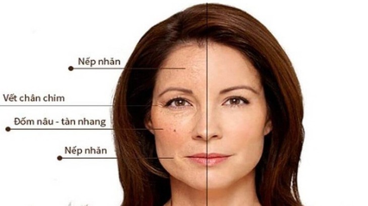 4 bước chăm sóc da tốt nhất duy trì sự trẻ trung cho U40 đón Tết- Ảnh 1.