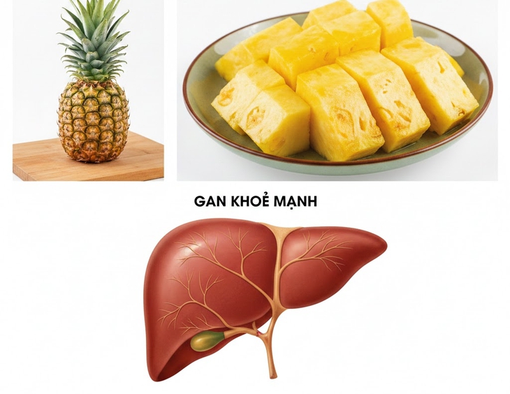 3 thay đổi bất ngờ của cơ thể khi ăn dứa thường xuyên- Ảnh 1. 3 thay đổi bất ngờ của cơ thể khi ăn dứa thường xuyên- Ảnh 1.