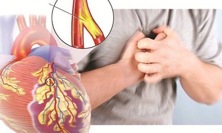 Lối sống thiếu lành mạnh, stress kéo dài cùng những thói quen sinh hoạt không khoa học đang trở thành yếu tố nguy cơ hàng đầu khiến người trẻ mắc bệnh tim mạch