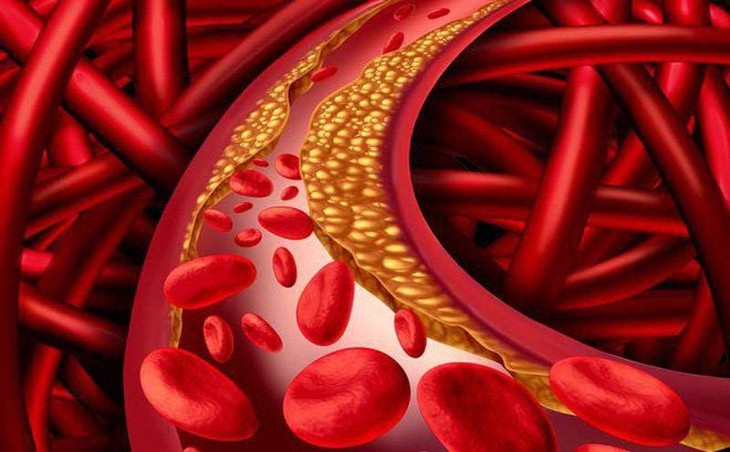 Giảm cholesterol bằng thực dưỡng: Chìa khóa bền vững bảo vệ tim mạch từ bữa ăn hằng ngày- Ảnh 1. Giảm cholesterol bằng thực dưỡng: Chìa khóa bền vững bảo vệ tim mạch từ bữa ăn hằng ngày- Ảnh 1.