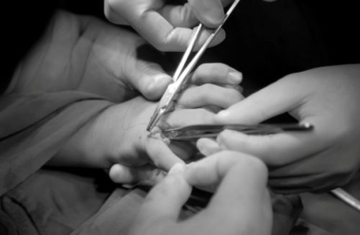 Khi phát hiện trẻ có dấu hiệu thừa ngón tay, cha mẹ nên đưa trẻ đến cơ sở y tế để được tư vấn và điều trị kịp thời. Ảnh minh hoạ