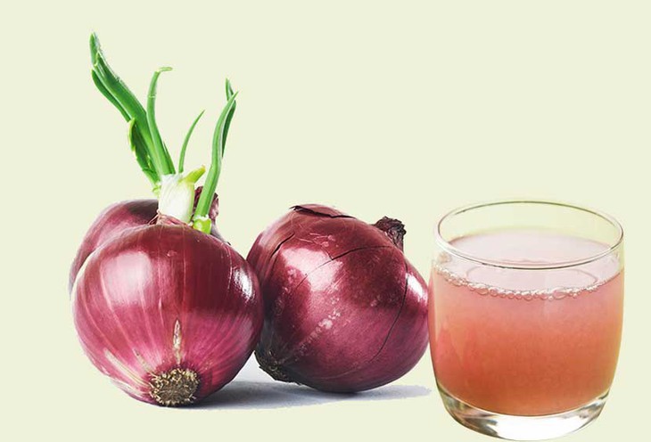 Nước ép hành tây có giúp tóc mọc nhanh hơn?- Ảnh 1.