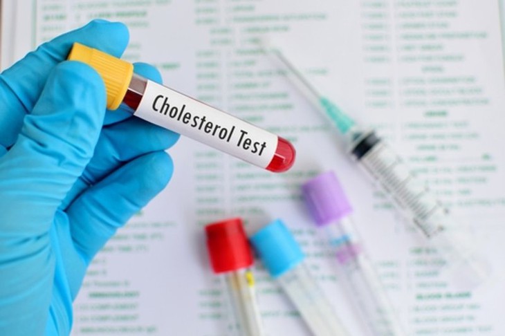 5 cập nhật mới về quản lý cholesterol không cần dùng thuốc- Ảnh 1.