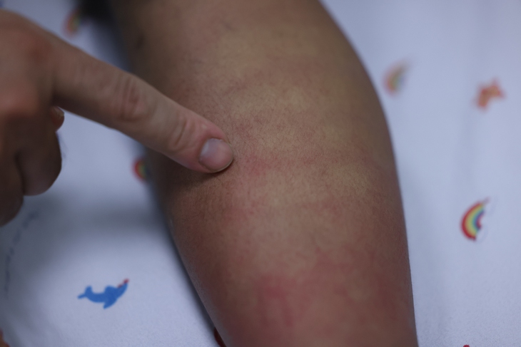 Sốt xuất huyết Dengue và những dự định dở dang bên giường bệnh- Ảnh 2.