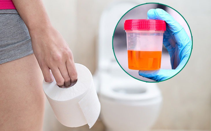Không chủ quan khi tiểu ra máu - Ảnh 1.