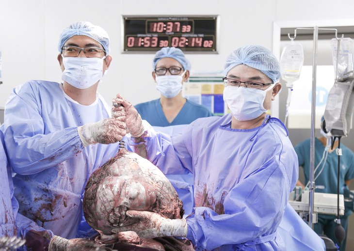 Bụng to bất thường, cô gái 25 tuổi phát hiện u xơ tử cung gần 12kg- Ảnh 2.