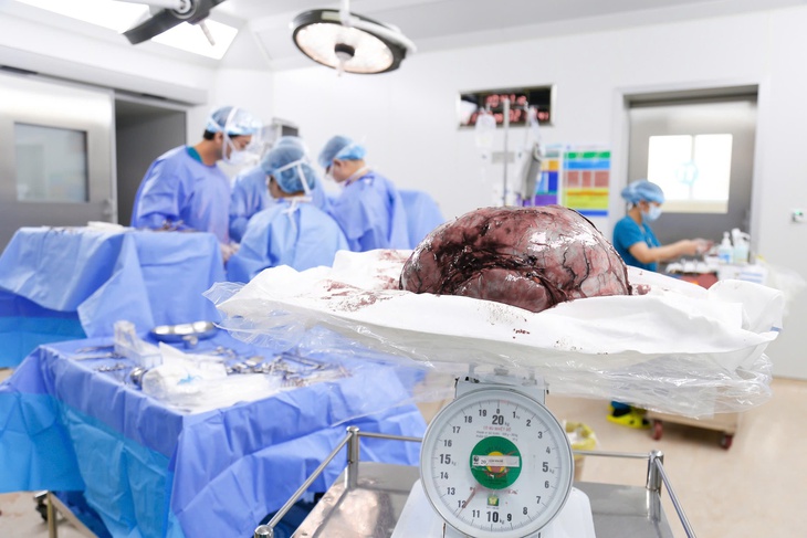 Bụng to bất thường, cô gái 25 tuổi phát hiện u xơ tử cung gần 12kg- Ảnh 3.