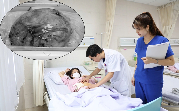 Cùng lúc nhiễm nhiều loại giun sán, gan của cụ bà chứa toàn mủ đục- Ảnh 1.
