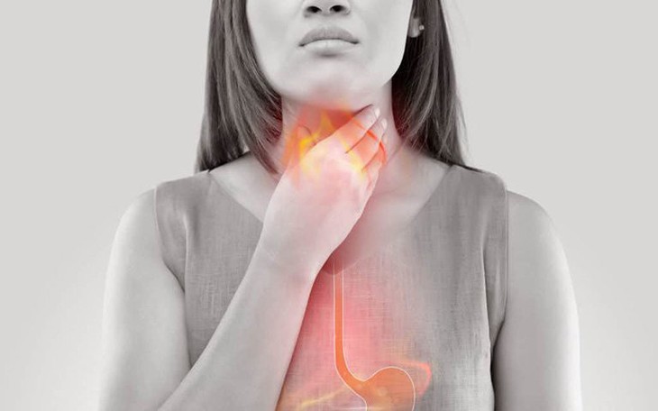 Ợ chua do đâu và cách xử trí?- Ảnh 1.