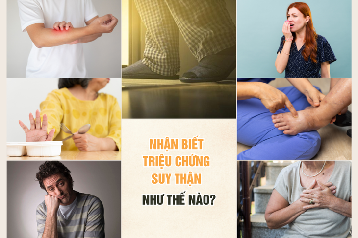 Nhận biết triệu chứng suy thận như thế nào?- Ảnh 2. Nhận biết triệu chứng suy thận như thế nào?- Ảnh 2.