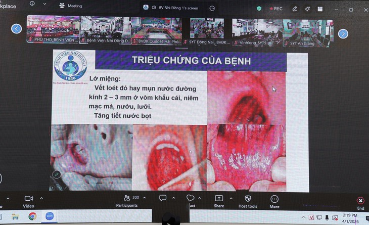 Đã có gần 100.000 ca tay chân miệng, Bộ Y tế nhắc phải phòng chống từ nhàtrường - Ảnh 1.
