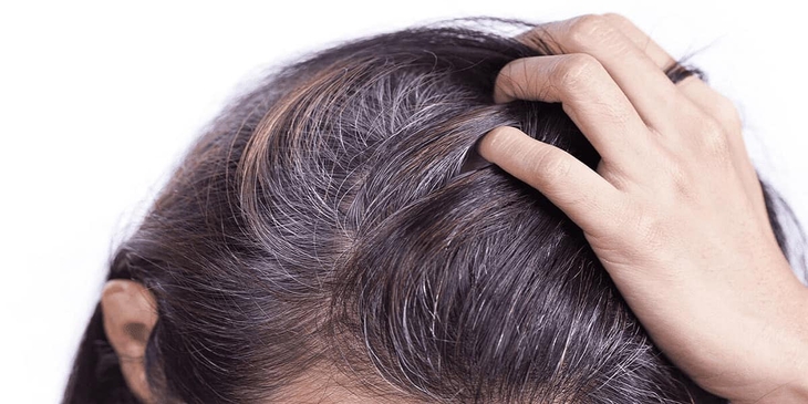 Bí quyết ngăn ngừa tóc bạc sớm từ quả dâu tằm- Ảnh 1. Bí quyết ngăn ngừa tóc bạc sớm từ quả dâu tằm- Ảnh 1.