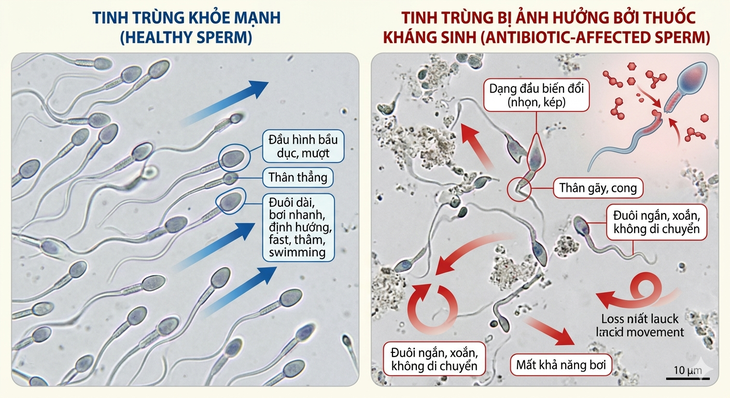 Thuốc kháng sinh ảnh hưởng thế nào đến khả năng sinh sản? - Ảnh 1.