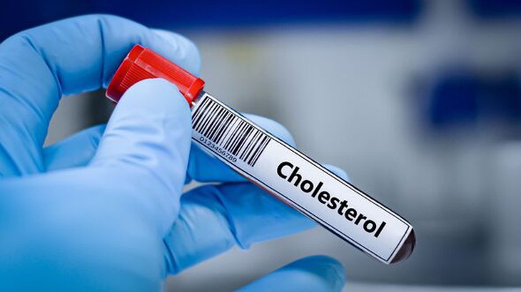 5 biện pháp không dùng thuốc kiểm soát cholesterol cao hiệu quả- Ảnh 1.